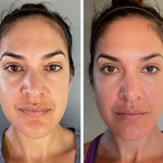 Masajeador facial led