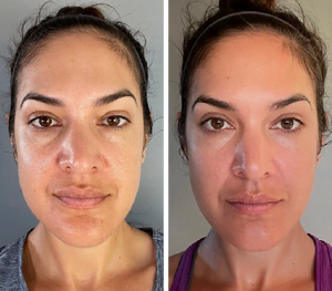 Masajeador facial led