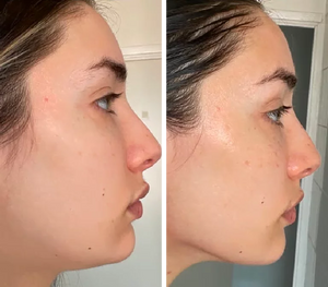 Masajeador facial led